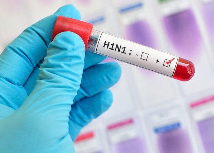 CÚM A H1N1: KOMTUM CÁCH LY CẶP VỢ CHỒNG CÓ KẾ QUẢ DƯƠNG TÍNH